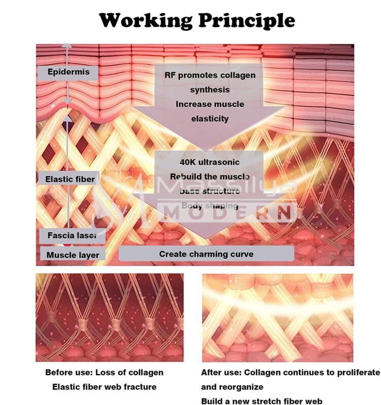 BEAUTY Cavitation machine 6 Slimming – Image 6