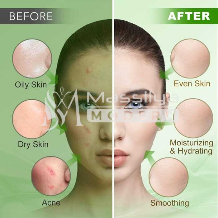 IREV masque peel off powder Tea Tree Jelly Mask – Purifiant & Anti-Acné 500g – Image 3